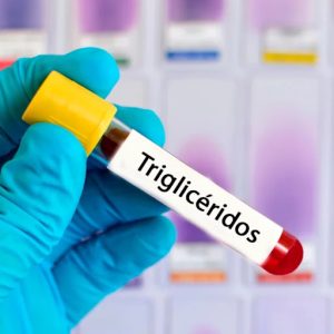 TRIGLICERIDOS